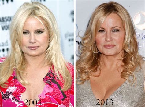 jennifer coolidge before plastic surgery|Jennifer Coolidge Plastic Surgery: Shocking Before and After Look!